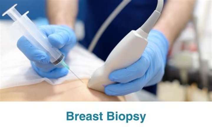 Uncover The Cost Of Breast Biopsy: A Financial Guide